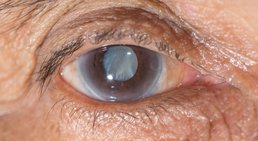 Dr. med. Ivo Durkovic, MPH - Augenarzt 9020 Klagenfurt am Wörthersee