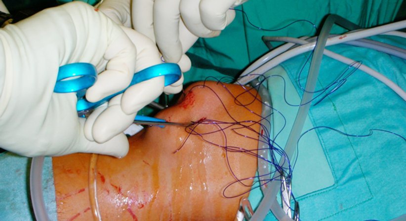 Knie - Dr. Paul Stampfl - Unfallchirurg Wien 1090