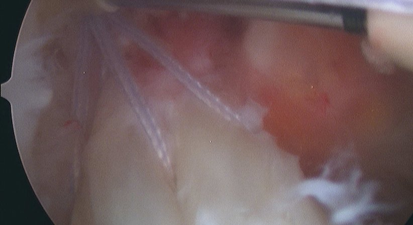 Knie - Dr. Paul Stampfl - Unfallchirurg Wien 1090