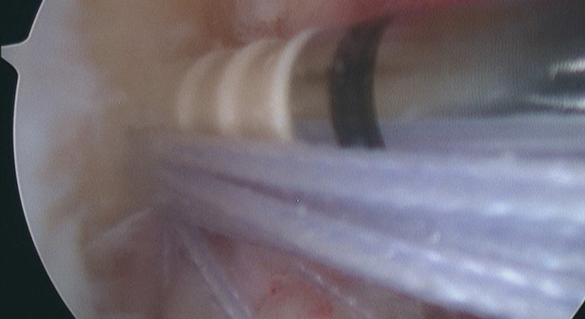 Knie - Dr. Paul Stampfl - Unfallchirurg Wien 1090