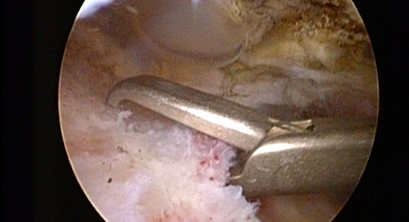 Schulter - Dr. Paul Stampfl - Unfallchirurg Wien 1090