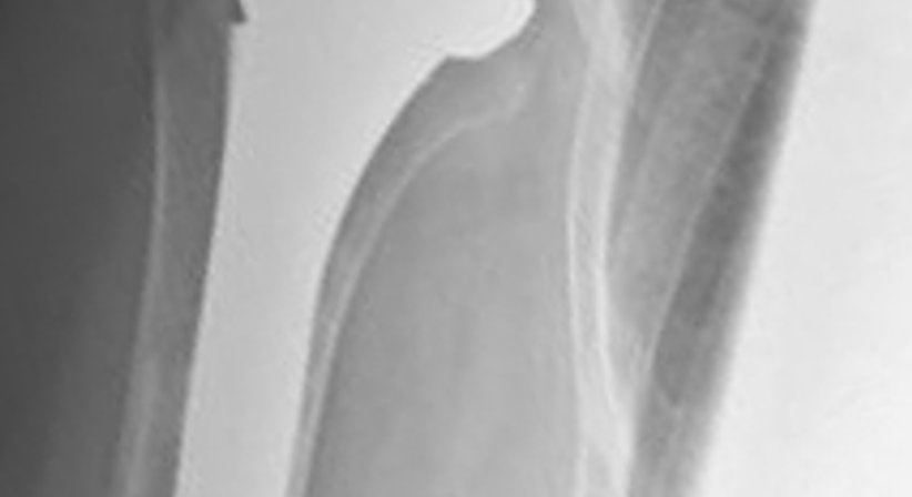 Schulter - Dr. Paul Stampfl - Unfallchirurg Wien 1090