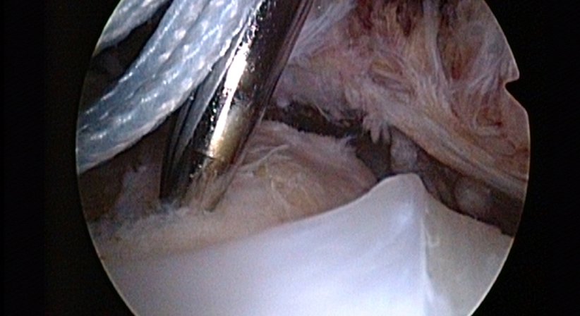 Schulter - Dr. Paul Stampfl - Unfallchirurg Wien 1090