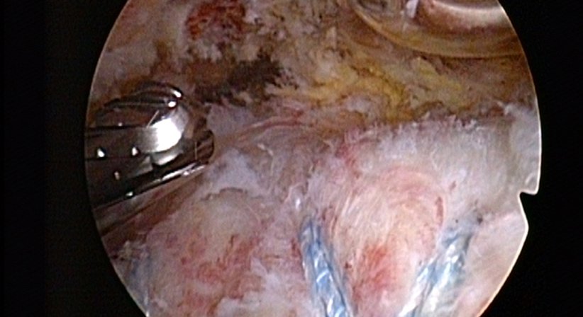 Schulter - Dr. Paul Stampfl - Unfallchirurg Wien 1090