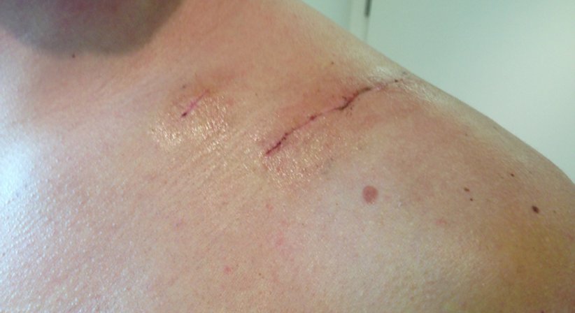 Sporttraumatologie - Dr. Paul Stampfl - Unfallchirurg Wien 1090