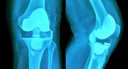 Dr. Matthias Brenner - Orthopäde Wien 1010