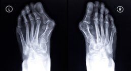 Dr. Stefan Dittrich - Orthopäde Mödling 2340