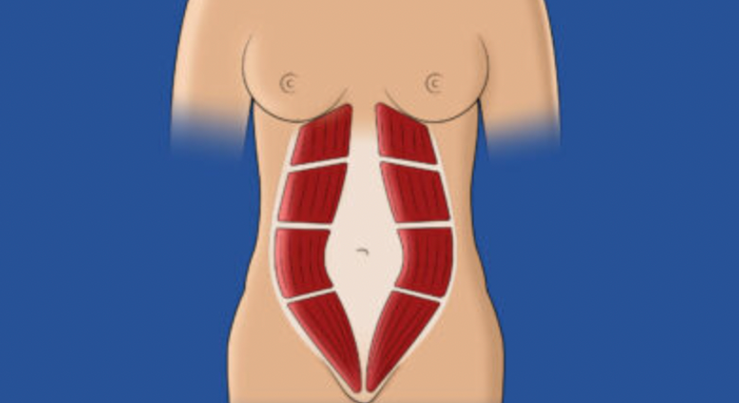 Rektusdiastase  | "MummyTummy"  - OA Dr. Teodor Kapitanov, FEBS - AWS - Allgemeinchirurg/Viszeralchirurg Wien 1060