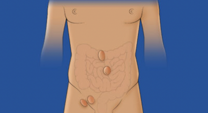 Spezialist für Bauchwand- und Hernienchirurgie in Wien (FEBS - AWS)