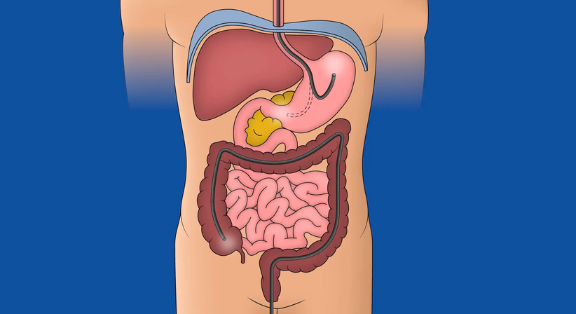 Vorsorge | Magen- und Darmspiegelung - OA Dr. Teodor Kapitanov, FEBS - AWS - Allgemeinchirurg/Viszeralchirurg Wien 1180