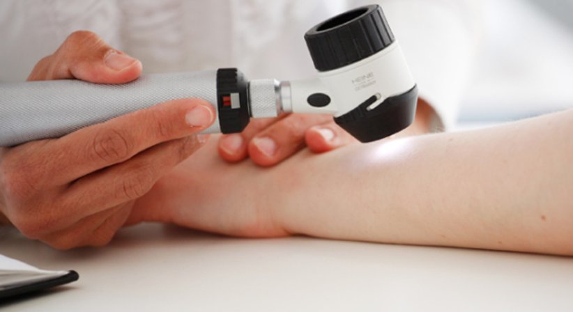 Nicht operative Behandlung - Dr. Katharina Ponholzer - Hautärztin Wien 1190