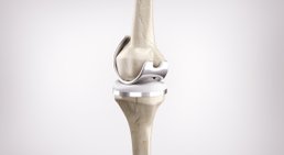 Dr. med. univ. Georg Neubauer - Orthopäde Neunkirchen 2620