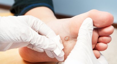 Kleine operative Eingriffe