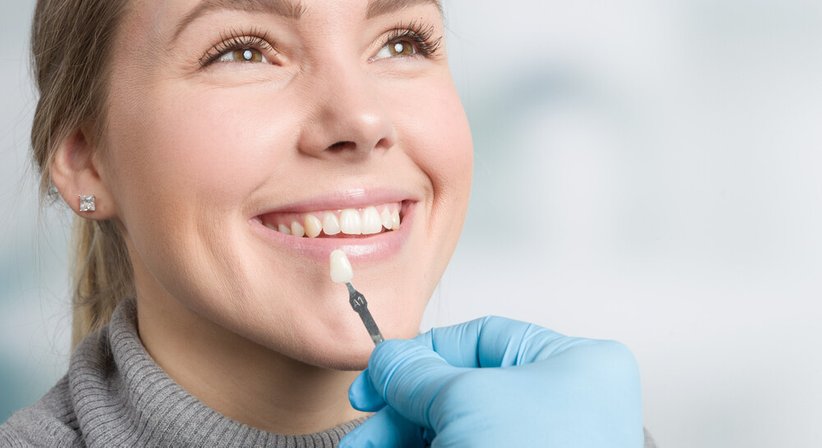 Veneers - Dr. med. dent. Veit Vinzenz Fiala - Zahnarzt Wien 1010