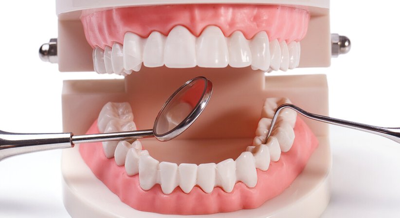 Resektive und regenerative Parochirurgie - Dr. med. dent. Veit Vinzenz Fiala - Zahnarzt Wien 1010