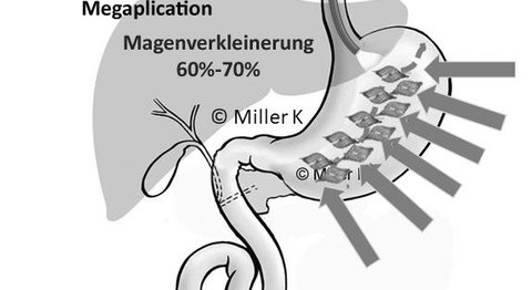 Univ.Doz. Dr. Prof. Karl  Miller - Allgemeinchirurg/Viszeralchirurg Salzburg 5020