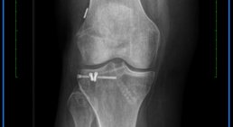 OA Dr. Dominik Roider - Orthopäde Wien 1180