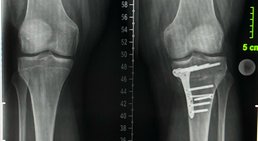 OA Dr. Dominik Roider - Orthopäde Wien 1180