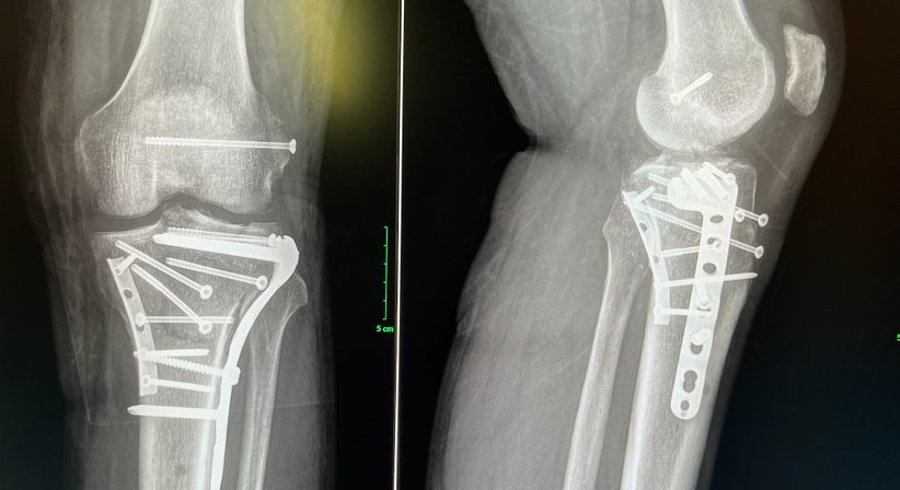 rekonstruktive Kniechirurgie - OA Dr. Dominik Roider - Orthopäde Wien 1180