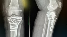 OA Dr. Dominik Roider - Orthopäde Wien 1180