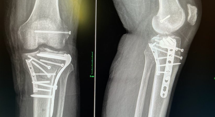 Unfallchirurgie - OA Dr. Dominik Roider - Orthopäde Wien 1180