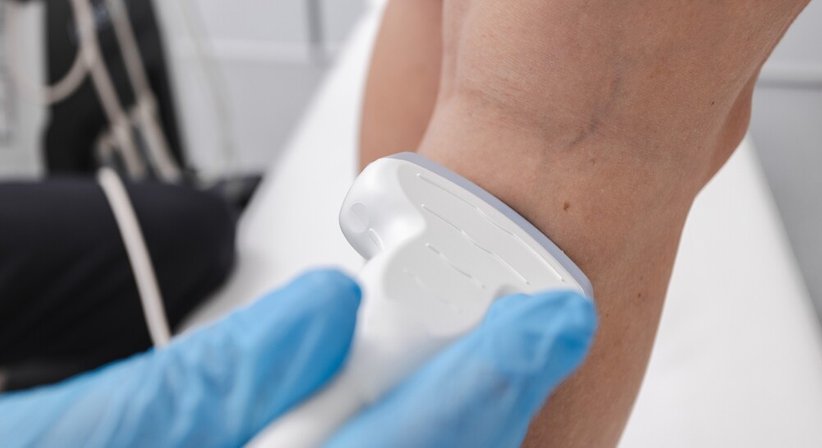 Venenmedizin - Dr. Boryana Gaydeva - Allgemeinchirurgin Wien 1060