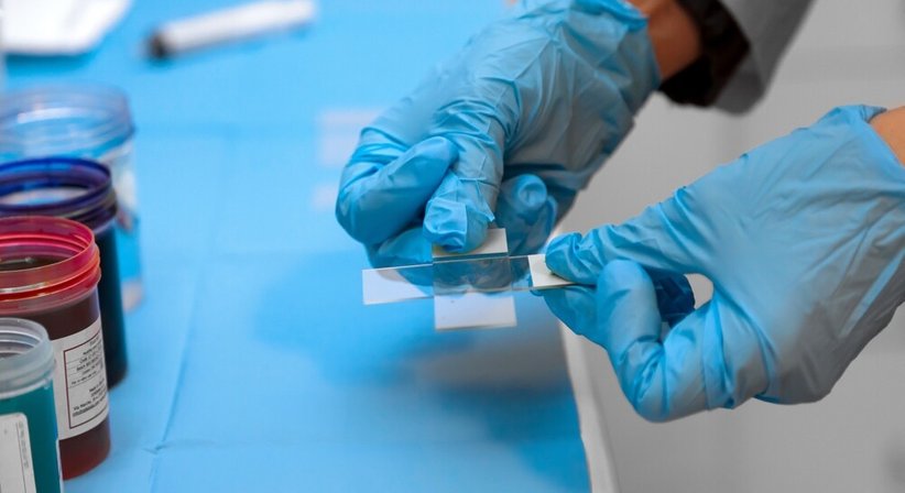 Feinnadelaspiration (FNA) - Dr. Dariush Rafiei - Nuklearmediziner Wien 1200