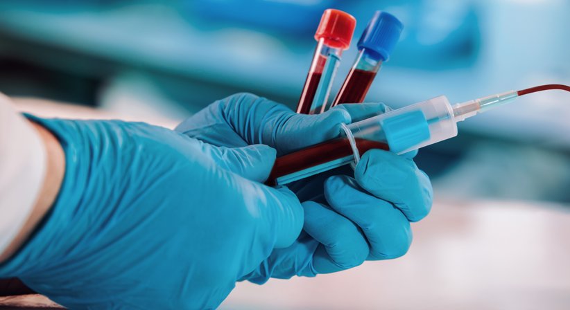 Blutabnahme / Labordiagnostik - Dr. Dariush Rafiei - Nuklearmediziner Wien 1200