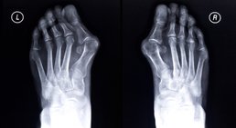 OA Priv. Doz. Dr. Christoph Stihsen - Orthopäde Wien 1150