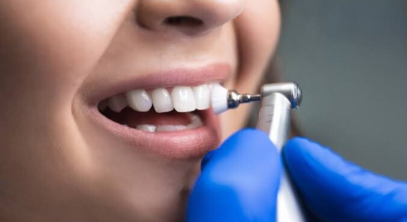 Professionelle Mundhygiene & Prophylaxe (1010 Wien) bei Dr. med. dent. Ditjon Bytyqi