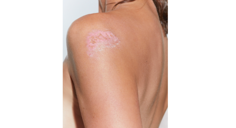 Meine Gesundheit - Dr. Reinhard Pauzenberger - Plastischer Chirurg Wels 4600