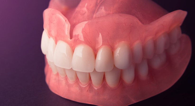 Teil- und Vollprothesen - DDr. Anna Jung - Zahnärztin Wien 1120