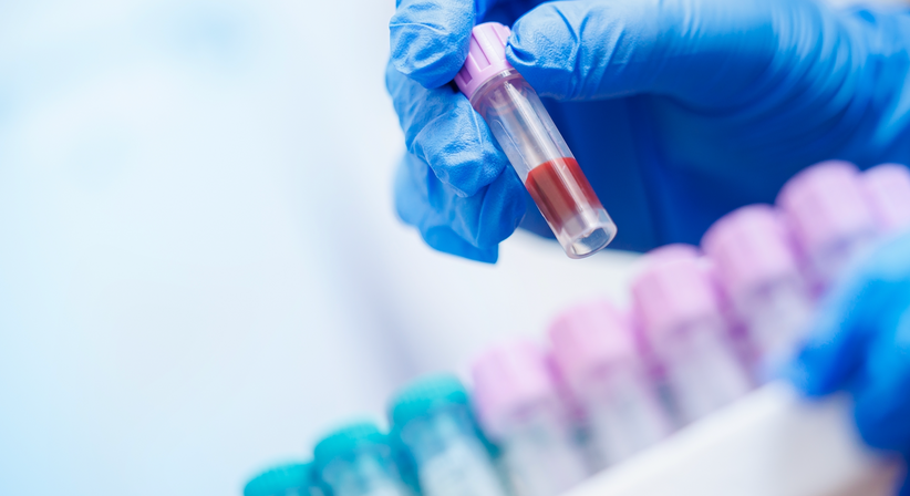 Blutabnahme/ Laboruntersuchungen/ Schnelltests - Dr. med. Clemens Ziller - Allgemeinmediziner und Familienmediziner Wien 1010