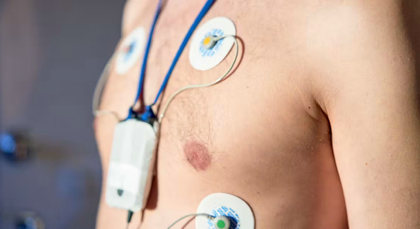 Langzeit-EKG/ Holter-EKG - OA Dr. med. univ. Aysar Aisamee - Kardiologe Wien 1100