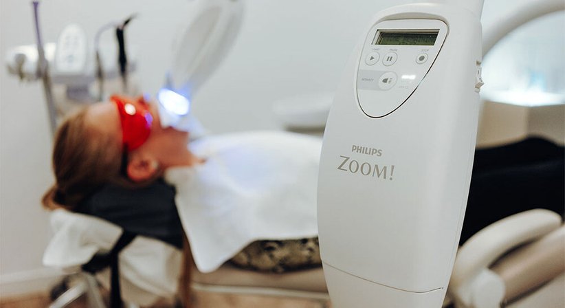 Bleaching - Dr. med. dent. Azam Gomari - Zahnärztin Wien 1210
