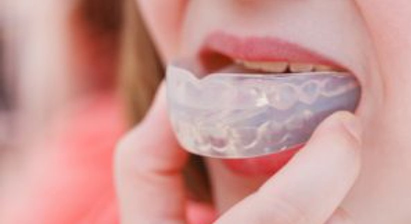 Knirscher- und Sportschutzschiene - Dr. med. dent. Azam Gomari - Zahnärztin Wien 1210