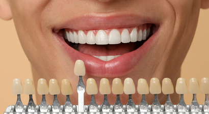 Konservierende Zahnmedizin (Inlays, Onlays, Kronen, Brücken, Kompositfüllungen)