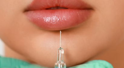 Lippenunterspritzung /Lippenvergrößerung 