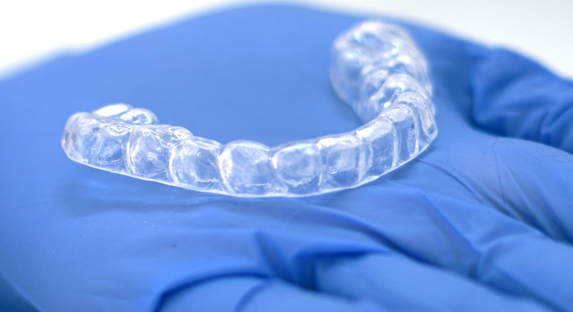 Unsichtbare Zahnspange (Aligner) - DDr. Nicole Kinastberger - Zahnärztin Wien 1010