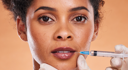 Fillerbehandlung/Faltenunterspritzung mit Hyaluronsäure  