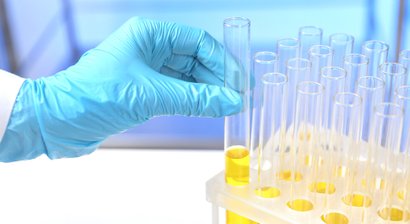 Harn- und Stuhluntersuchung