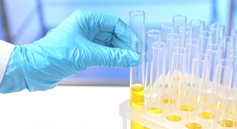 Harn- und Stuhluntersuchung - Dr. Nicole Walter-Publig - Praktische Ärztin Wien 1220