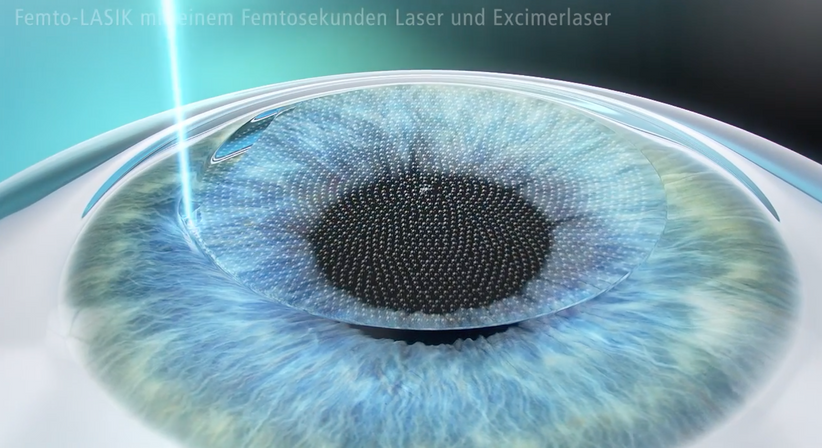 Femtosekunden-LASIK - Prof. Dr. Dr.  Nikolaus Luft, FEBO, FWCRS - Augenarzt Linz 4020