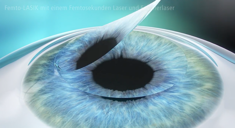 Femtosekunden-LASIK - Prof. Dr. Dr.  Nikolaus Luft, FEBO, FWCRS - Augenarzt Linz 4020