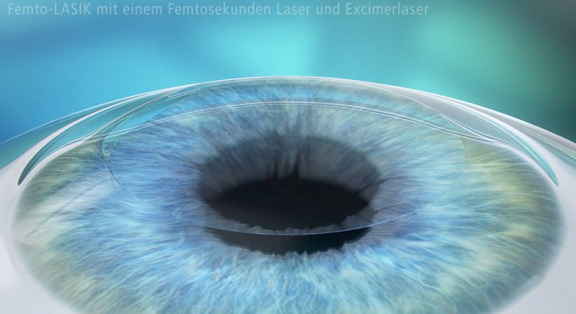 Femtosekunden-LASIK - Prof. Dr. Dr.  Nikolaus Luft, FEBO, FWCRS - Augenarzt Linz 4020