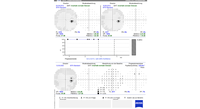 Grüner Star (Glaukom)  - Prof. Dr. Dr.  Nikolaus Luft, FEBO, FWCRS - Augenarzt Linz 4020