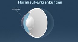 Prof. Dr. Dr. Nikolaus Luft, FEBO, FWCRS - Augenarzt Linz 4020