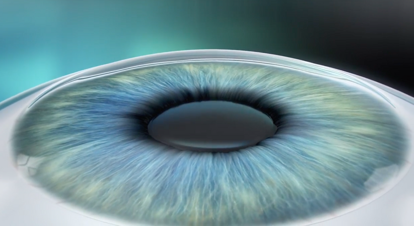 ICL – Implantierbare Collamer Linse - Prof. Dr. Dr.  Nikolaus Luft, FEBO, FWCRS - Augenarzt Linz 4020