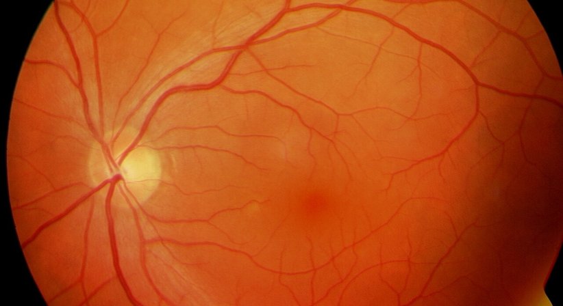 Makula-Erkrankungen - Prof. Dr. Dr.  Nikolaus Luft, FEBO, FWCRS - Augenarzt Linz 4020