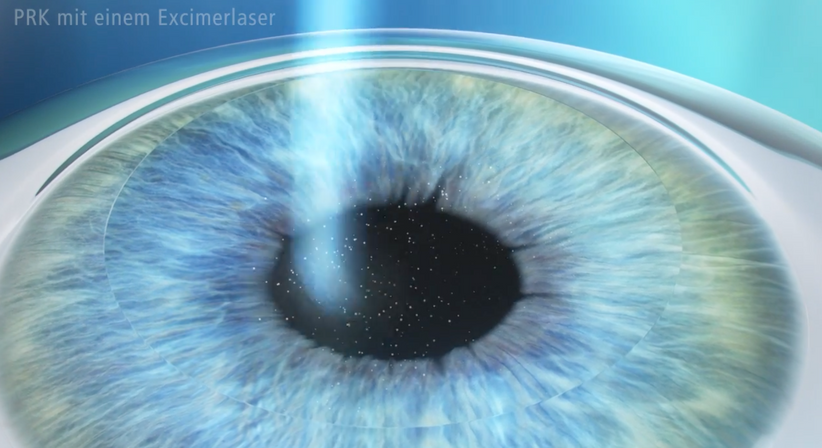 PRK (LASEK) - Prof. Dr. Dr.  Nikolaus Luft, FEBO, FWCRS - Augenarzt Linz 4020